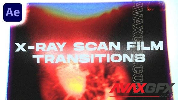 X-ray Scan Film Transitions | After Effects 47852397 [Videohive]
