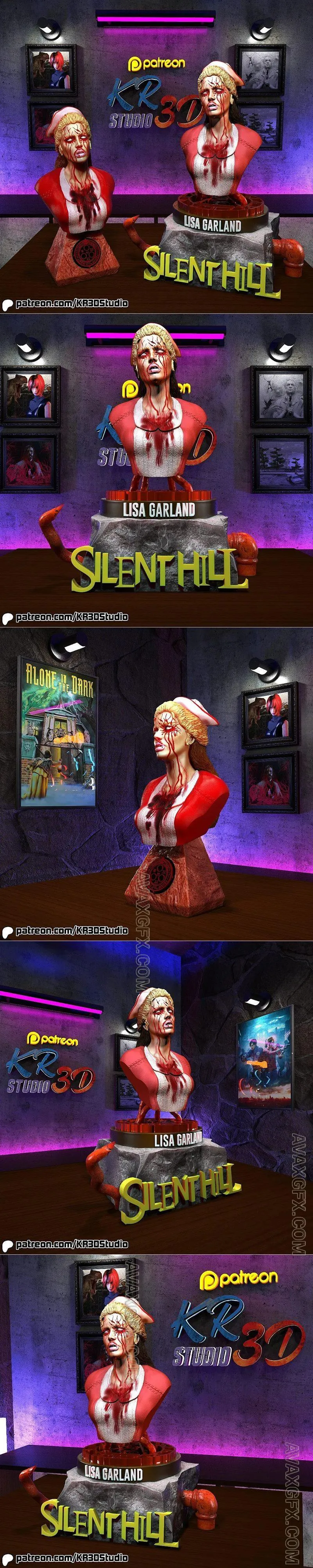Lisa Garland from Silent Hill Simple and Special Bust - STL 3D Model